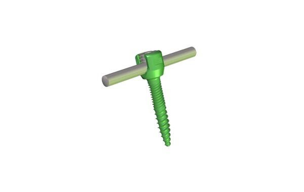 GREENS Monoaxial Screw 5.5mm rod system